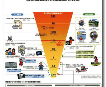 レントゲンのお話