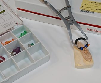 銀歯にしないで済む治療